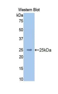 KNG1 / Kininogen / Bradykinin Antibody