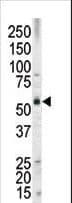 MLLT3 / AF9 Antibody (aa39-65)