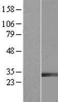 IGFBP7 / TAF Protein (Over-Expression Lysate Myc-DDK (Flag))