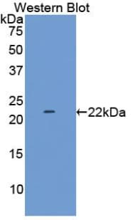 LAMC2 / Laminin Gamma 2 Antibody (aa28-196, APC)