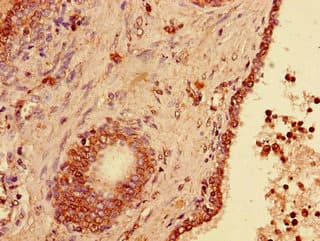 USP33 / VDU1 Antibody