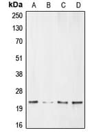 NIP3 / BNIP3 Antibody (Internal)