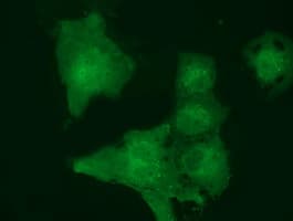 MOBKL2B / MOB3B Antibody (clone OTI6C6)