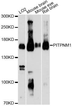 Polyclonal Rabbit anti-Human PITPNM1 / NIR2 Antibody (WB)