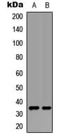 UCP3 Antibody (C-Terminus)