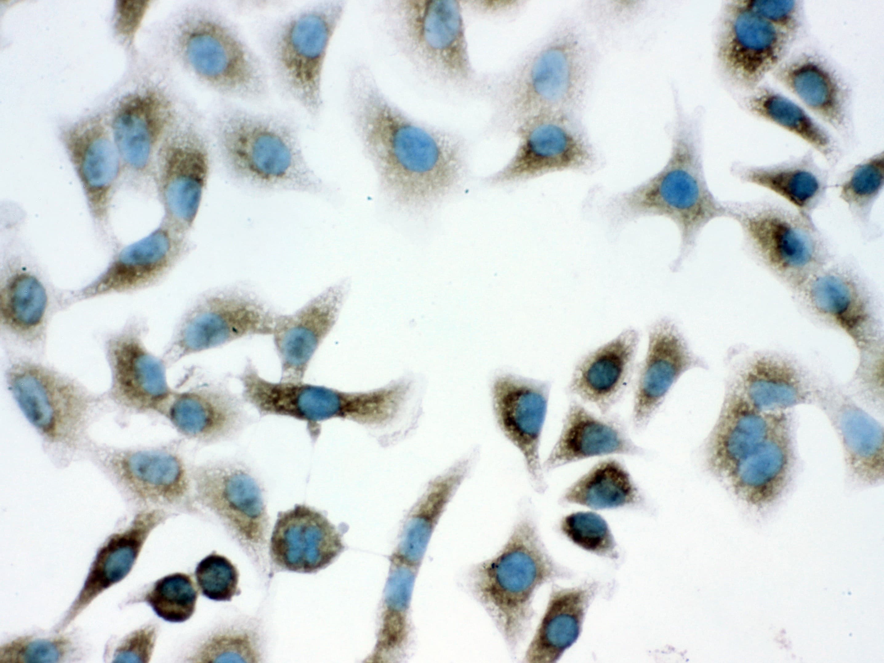 PARK7 / DJ-1 Antibody (aa2-189)