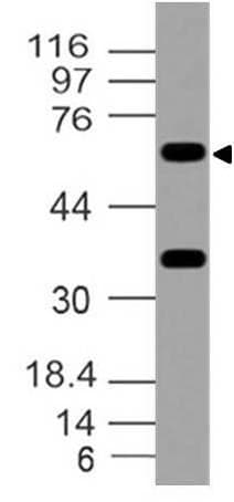 FOXO1 / FKHR Antibody