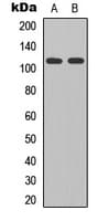 GRID2 Antibody (C-Terminus)