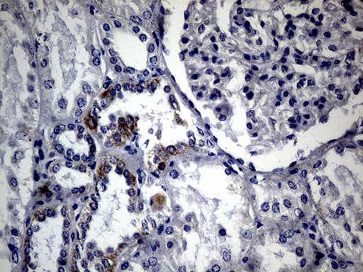 FOXP3 Antibody (clone OTI3D1, Carrier-free)