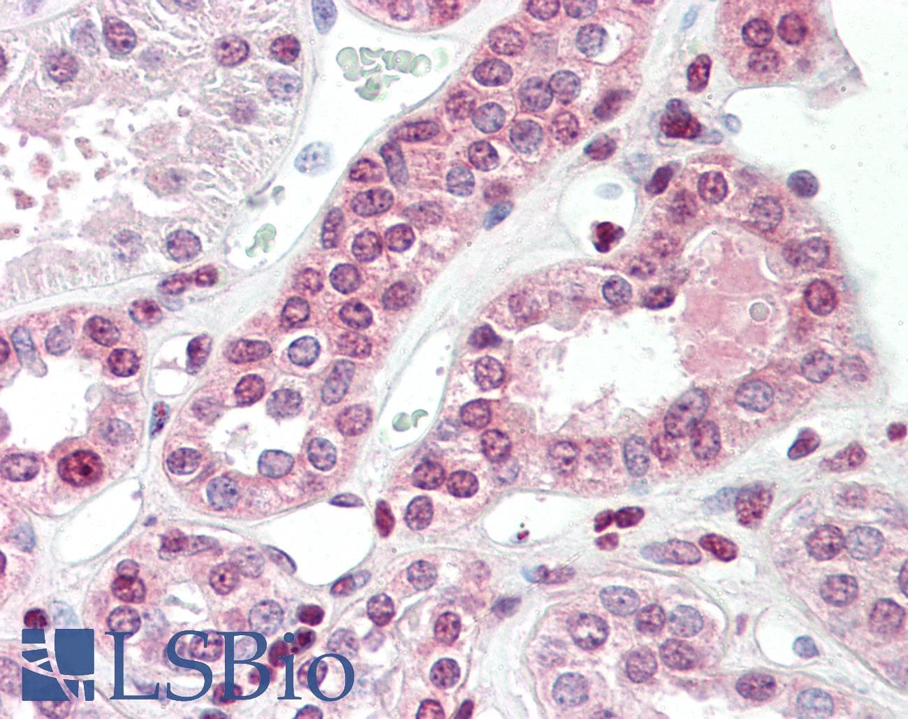 IHC-plus™ Polyclonal Goat anti-Human TGM7 / Transglutaminase 7 Antibody (aa119-131, IHC, WB)