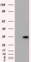 ERCC1 Antibody (clone OTI2A7)