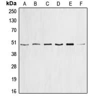 CCNE1 / Cyclin E1 Antibody (Internal)
