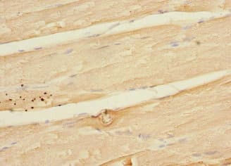 MAPKAPK3 Antibody