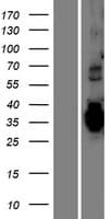 TMEM74B / C20orf46 Protein (Over-Expression Lysate Myc-DDK (Flag))