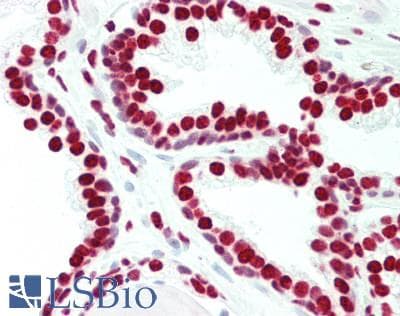 IHC-plus™ HNRPA1 / HnRNP A1 Antibody (aa36-85)
