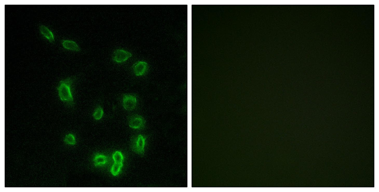 PPP1R1B / DARPP-32 Antibody (phospho-Thr34)