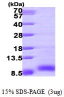 Human IGF2 Protein (Recombinant)