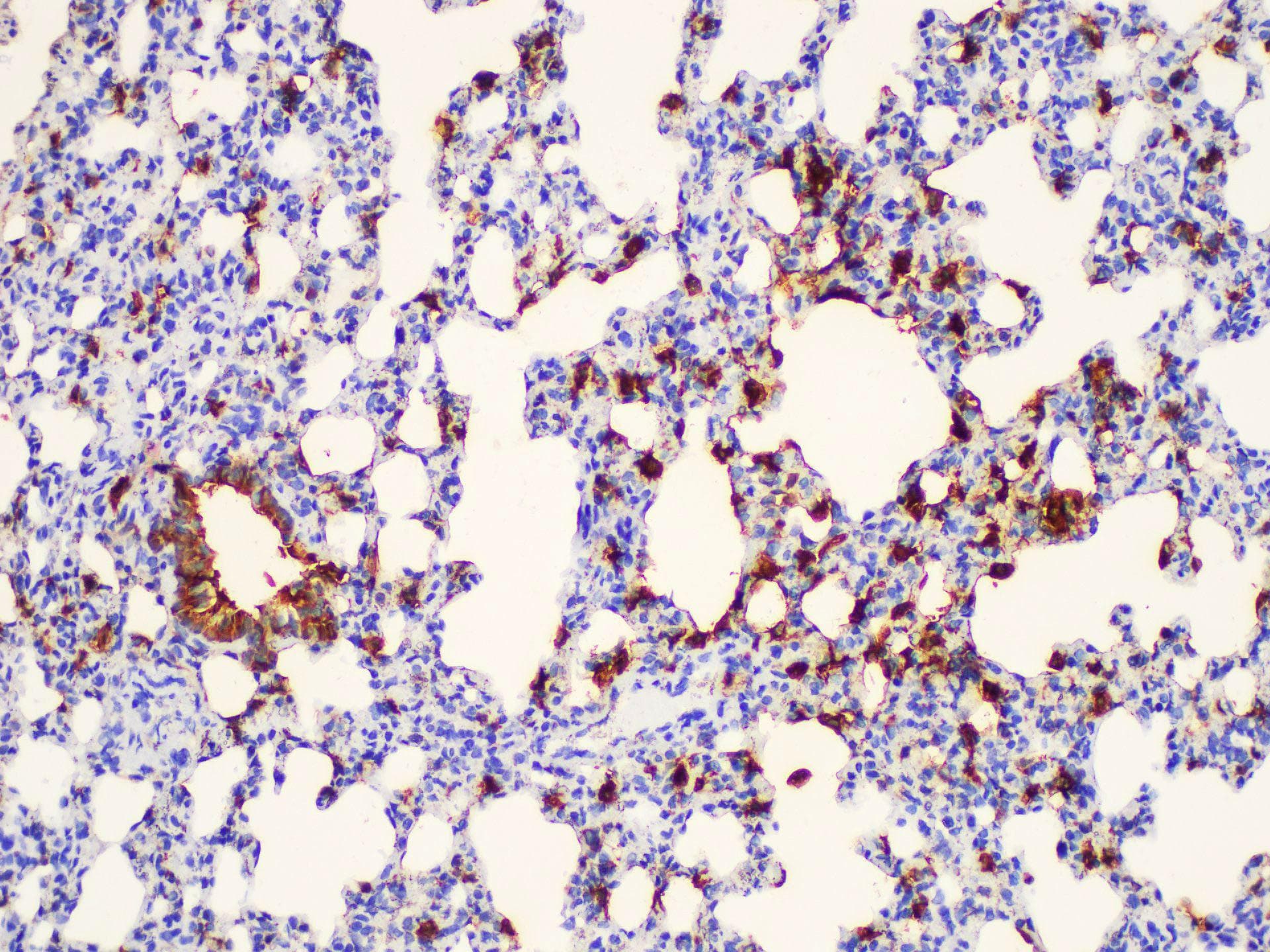 LGALS3 / Galectin 3 Antibody
