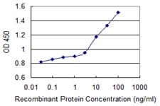 ARSB / Arylsulfatase B Antibody (clone 2G6)