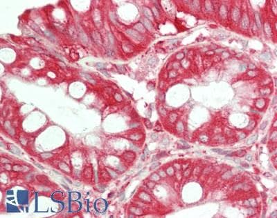 IHC-plus™ CAPN2 / Calpain 2 / M-Calpain Antibody (clone 1381CT669.7.66.71)
