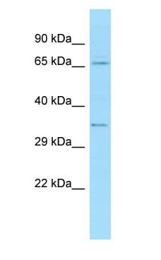 Polyclonal Rabbit anti-Human TXLNA / Alpha Taxilin Antibody (aa51-100, WB)