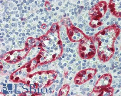 GIPC2 Antibody (aa1-315)