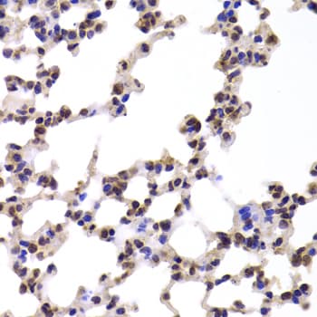 CMPK / CMPK1 Antibody