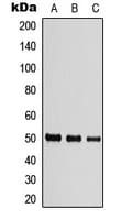 TUBB / Beta Tubulin Antibody (Internal)