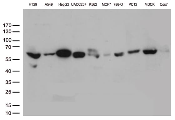 P5CDH / ALDH4A1 Antibody (aa1-503, clone OTI1H10)