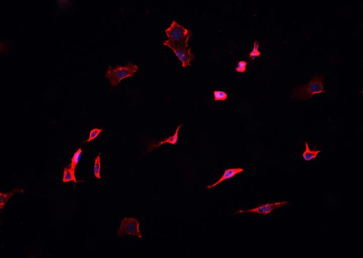 DCTN1 / Dynactin 1 Antibody