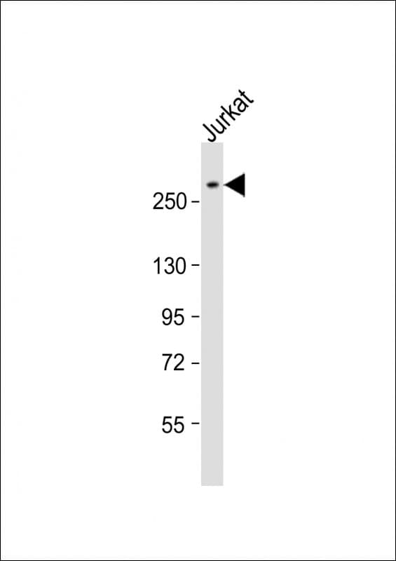 ARID1A / BAF250 Antibody (aa1930-1964)