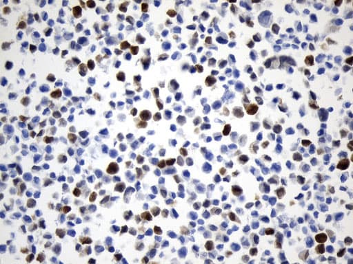 Monoclonal Mouse anti-Human UCHL1 / PGP9.5 Antibody (clone UMAB244, Carrier-free, IHC, WB)