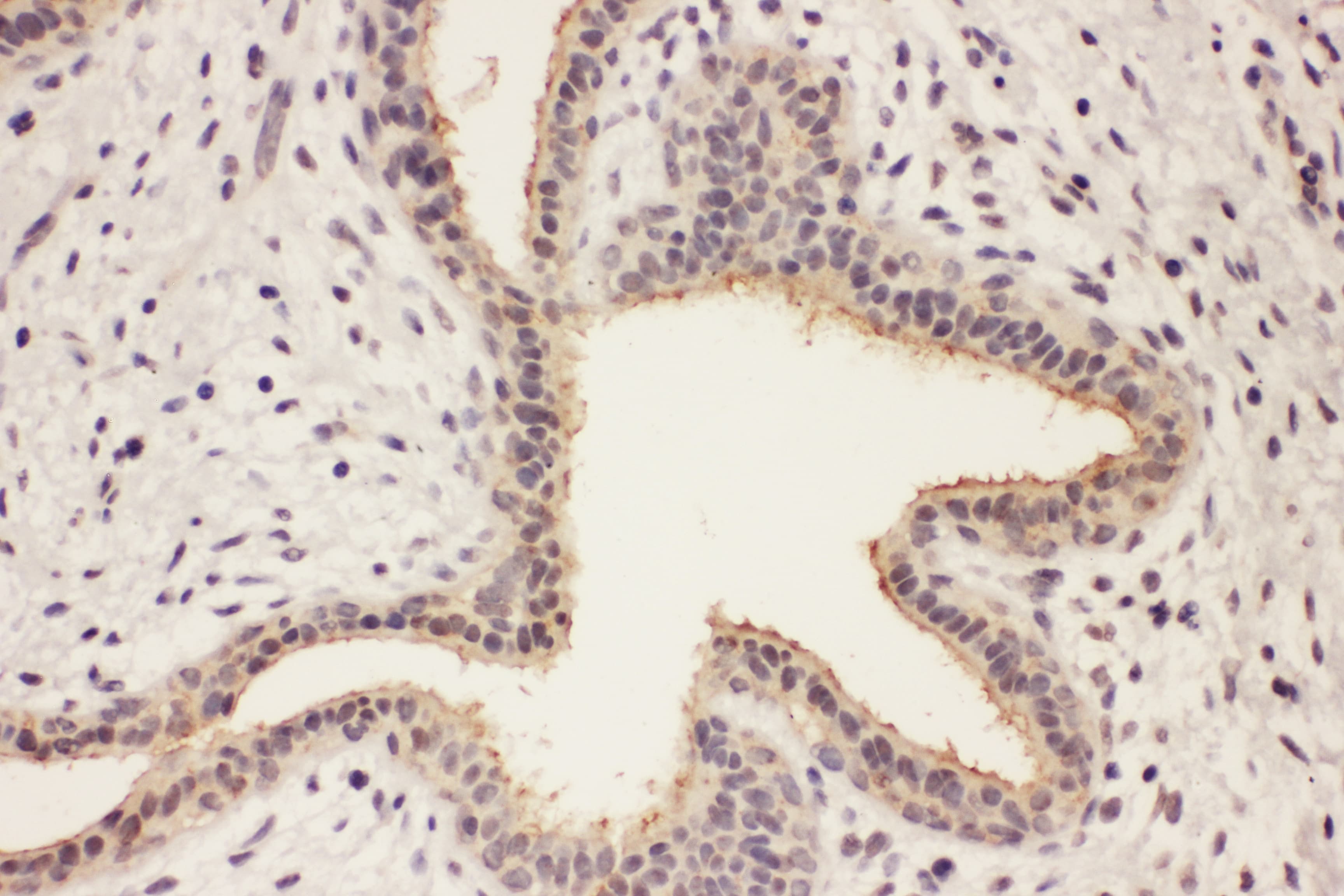 RAB8A / RAB8 Antibody (aa170-183)