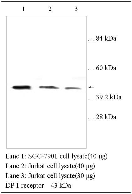 Prostaglandin D2 Receptor Antibody