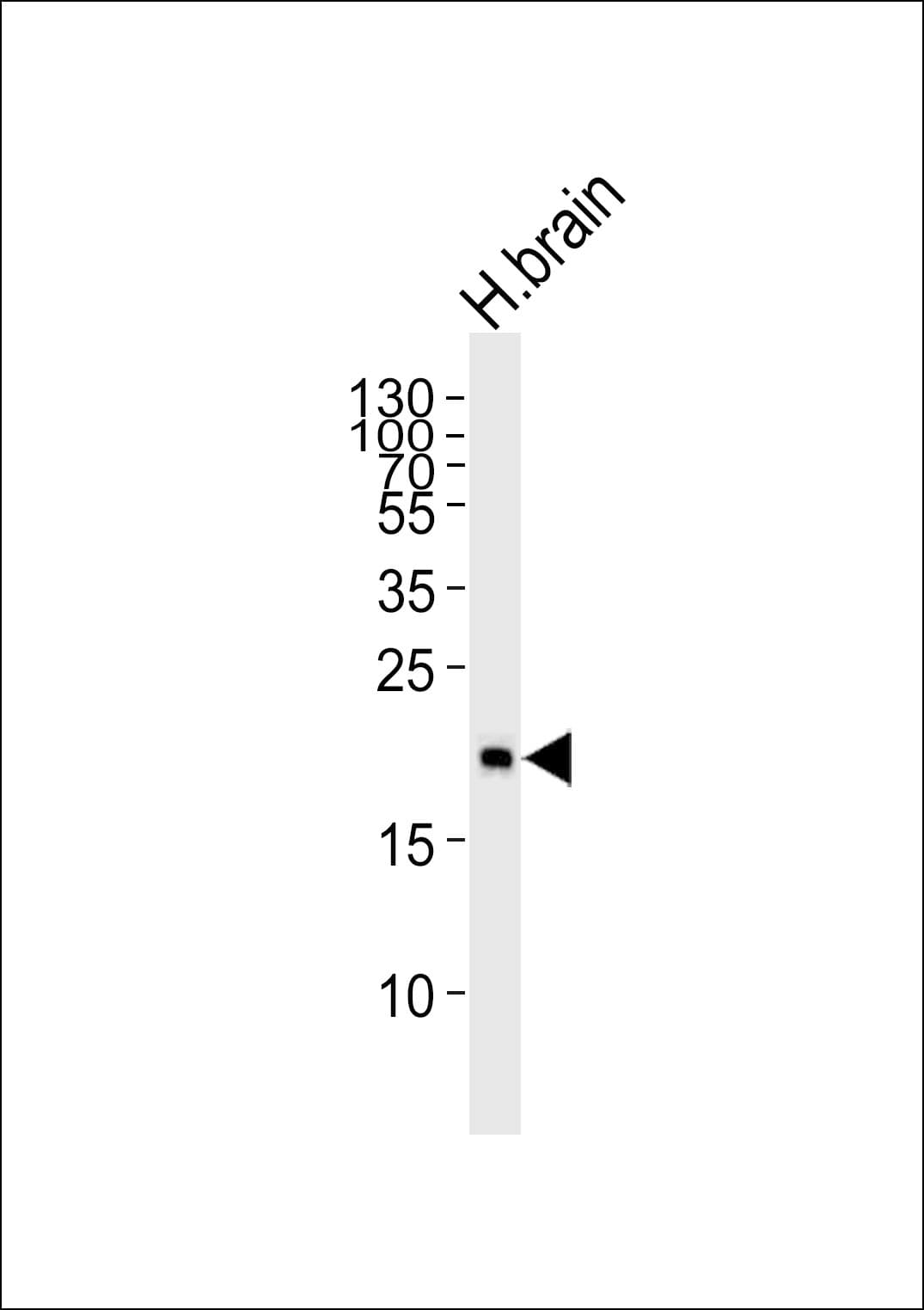 Polyclonal Rabbit anti-Human HPCA / Hippocalcin Antibody (aa2-32, IHC, WB)