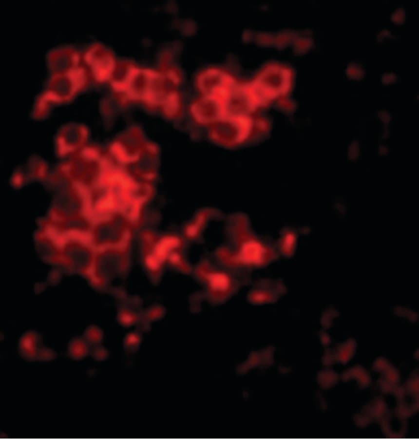Polyclonal Rabbit anti-Human LY96 / MD2 / MD-2 Antibody (IHC, IF, WB)