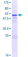 Human TSNAX / TRAX Protein (Recombinant GST)
