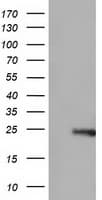 ARHGDIA / RHOGDI Antibody (clone OTI1F2, Carrier-free)