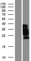 Human MBNL1 / MBNL Protein (Over-Expression Lysate Myc-DDK (Flag))