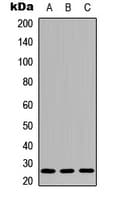 IL26 Antibody (Internal)