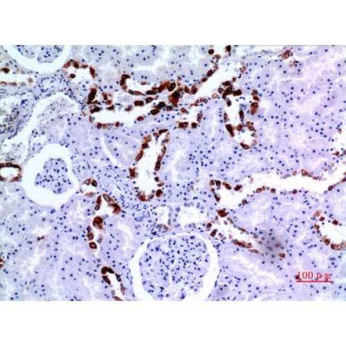 Polyclonal Rabbit anti-Human KRT8 / CK8 / Cytokeratin 8 Antibody (IHC, WB)