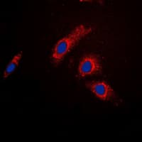 TBC1D4 / AS160 Antibody (Internal)