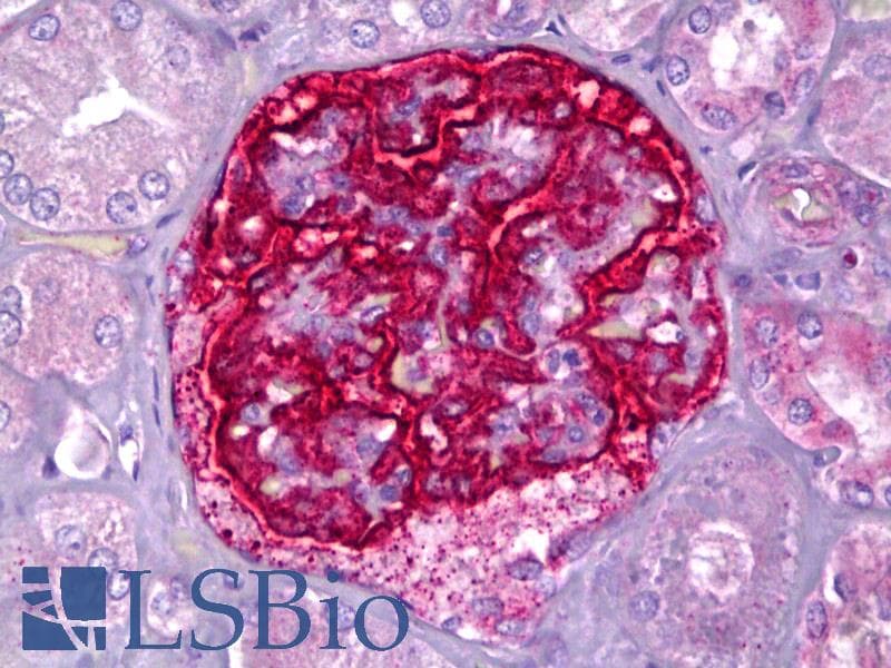 IHC-plus™ Polyclonal Rabbit anti-Human PJA2 Antibody (aa141-190, IHC, WB)
