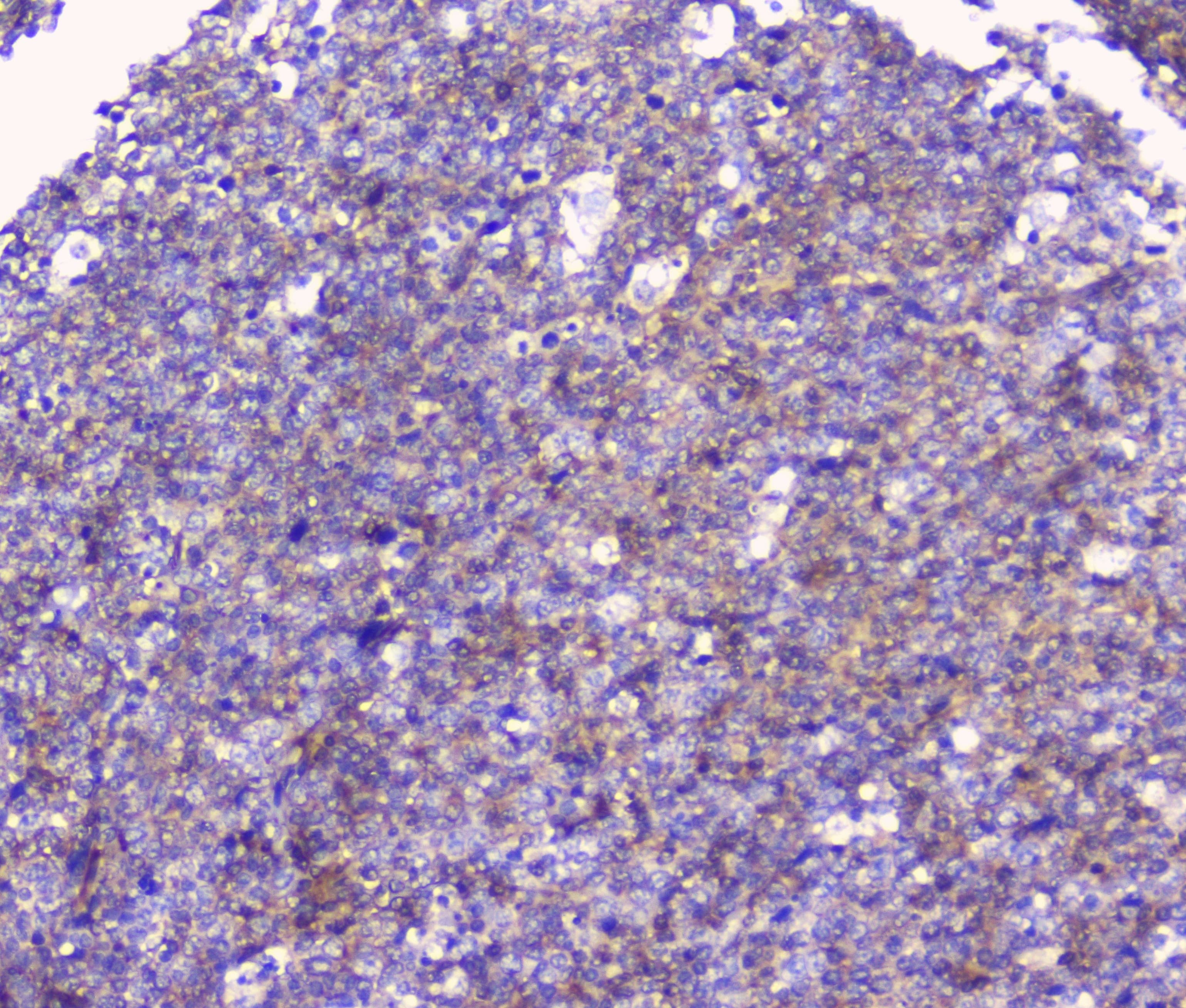 CD32A Antibody