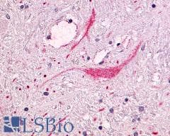 PathPlus™ NTSR1 / NTR Antibody (Cytoplasmic Domain)