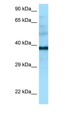 NAPSA / NAPA / Napsin A Antibody (aa195-244)
