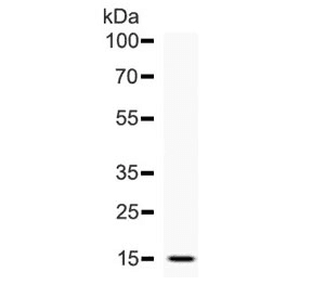 DDT / Dopamine Tautomerase Antibody (aa1-118)
