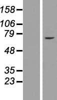 ZNF182 / ZNF21 Protein (Over-Expression Lysate Myc-DDK (Flag))