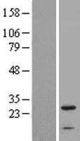Human IFITM2 Protein (Over-Expression Lysate Myc-DDK (Flag))