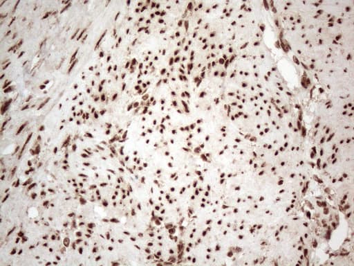 IRS1 Antibody (aa1-280, clone OTI3G10)